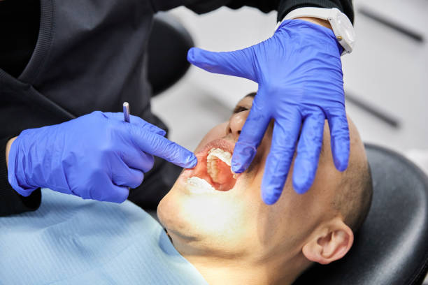 Best Emergency Root Canal Treatment in Lake Orion, MI
